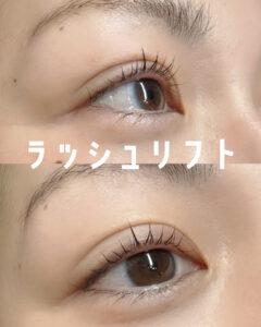 {"ARInfo":{"IsUseAR":false},"Version":"1.0.0","MakeupInfo":{"IsUseMakeup":false},"FaceliftInfo":{"IsChangeEyeLift":false,"IsChangeFacelift":false,"IsChangePostureLift":false,"IsChangeNose":false,"IsChangeFaceChin":false,"IsChangeMouth":false,"IsChangeThinFace":false},"BeautyInfo":{"SwitchMedicatedAcne":false,"IsAIBeauty":false,"IsBrightEyes":false,"IsSharpen":false,"IsOldBeauty":false,"IsReduceBlackEyes":false},"HandlerInfo":{"AppName":2},"FilterInfo":{"IsUseFilter":false}}